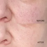 Perricone MD Hypoallergenic Clean Correction Smoothing Restorative Serum - Сыворотка для лица, увлажняющая и осветляющая кожу, сглаживающая, 59 мл — фото 6