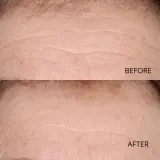Perricone MD Hypoallergenic Clean Correction Smoothing Restorative Serum - Сыворотка для лица, увлажняющая и осветляющая кожу, сглаживающая, 59 мл — фото 7