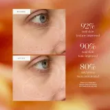KORA Organics Turmeric Glow Drops - Сыворотка для лица с ниацинамидом, 10 мл — фото 4