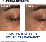 Uriage Age Absolu Blur-redensifying Eye Balm - Крем от морщин для области вокруг глаз, 15 мл — фото 6