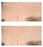 Perricone MD Essential Fx Acyl-Glutathione Serum - Сыворотка увлажняющая против глубоких морщин, 30 мл — фото 5