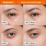 Dr. Jart+ Brightamin Brightening Eye Serum Stick - Сыворотка для глаз в стике, осветляющая, 3.6 г — фото 5
