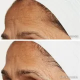 LANCER NOURISH REHYDRATION MASK - Маска для лица увлажняющая и питательная, 50 мл — фото 3