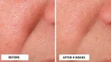 Perricone MD Cold Plasma Plus+ Advanced Serum - Сыворотка питательная для лица, 30 мл — фото 5