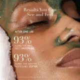 Omorovicza Moor Mud Refining Facial Polisher - Осветляющий пилинг, 100 мл — фото 6