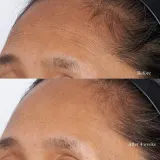Perricone MD High Potency Intensive Hydrating Mask - Интенсивно увлажняющая маска для лица с гиалуроновой кислотой, 59 мл — фото 4