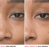 IT Cosmetics Bye Bye Pores - Сыворотка для лица с эффектом выравнивания и отшелушивания, 30 мл — фото 7