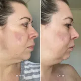 Alpha-H Vitamin A - Сыворотка с витамином А, 25 мл — фото 2