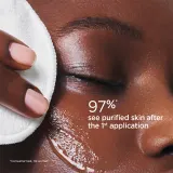 Clarins My Clarins Pure-Reset Purifying Matifying Toner - в контексте того, что это тоник для лица: очищающий и матирующий тоник, 200 мл — фото 5