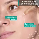 Uriage Hyseac New Skin Serum Anti-Blemish Booster - Сыворотка для жирной и проблемной кожи, 30 мл — фото 3
