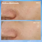 Origins Clear Improvement Blackhead Clearing Mask-To-Scrub - Очищающая маска против угрей, 75 мл — фото 4