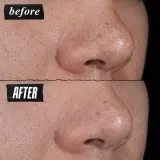 Kiehl's Rare Earth Deep Pore Cleansing Mask - Маска глубокого очищения с глиной, 125 мл — фото 5