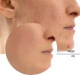 Revox B77 Skintreats Biotic Rebalancing Smoothing Gel - Легкий крем-гель для гладкой и матовой кожи, 50 мл — фото 8