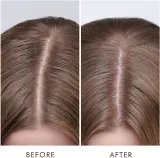 Moroccanoil Scalp Dry Scalp Treatment - Глубоко питательная маска для сухой кожи, 45 мл — фото 3