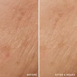 LANCER TRIPLE PEPTIDE DROPS - в контексте того, что это сыворотка для лица: омолаживающая сыворотка с пептидами, 30 мл — фото 7