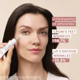 Avène Hyaluron Activ Procedure Micro-Lift Eye & Lip Cream 0.05% Retinal - Лифтинг-крем с ретинолом, 15 мл — фото 4
