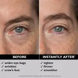 Peter Thomas Roth FIRMx® Eye Duo Set - Подарочный набор против морщин вокруг глаз — фото 3