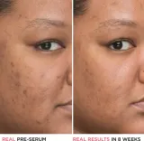 IT Cosmetics Bye Bye Dark Spots - Осветляющая сыворотка для лица с ниацинамидом, корректирующая пигментные пятна, 30 мл — фото 7