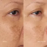 Perricone MD Hypoallergenic Clean Correction Moisturizer - увлажняющий питательный крем, 59 мл — фото 7