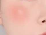 Banila Co. Romantic Blush - Многофункциональный косметический продукт для макияжа губ и щек, придающий идеальный вид, 3.7 г, оттенок 13 Cream Coral — фото 3