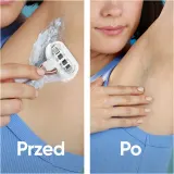 Gillette Venus PRO Smooth Sensitive - Запасные лезвия + защитный колпачок, 10 шт — фото 8