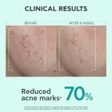 Apivita Just Bee Clear Serum - Сыворотка для жирной и проблемной кожи, 30 мл — фото 5