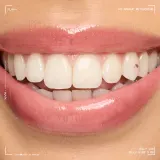 NYX Professional Makeup Jelly Job - Блестящий блеск для губ с эффектом увеличения, 7.5 мл, оттенок Jelly Kiss´d — фото 4
