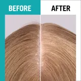 Schwarzkopf Gliss Scalp Balance - Увлажняющая сыворотка для кожи головы, 100 мл — фото 5