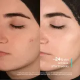 SKINSOO PurifyCell Exosome Cleanser - Очищающий скраб-гель, 250 мл — фото 7
