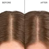 Капли для кожи головы KERASILK Specialists Moisturizing Scalp Drops увлажняющие, несмываемые, 100 мл — фото 2
