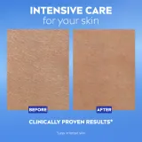 Молочко для тела NIVEA Repair Care для сухой кожи, восстанавливающее, 200 мл — фото 5