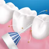 Ирригатор для полости рта Oral-B Aquacare 4 беспроводной, с технологией Oxyjet, 1 шт — фото 3