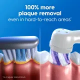 Электрическая зубная щётка Oral-B iO2 Clean Gentle с управлением одной кнопкой, 1 шт z etui podróżnym White — фото 2
