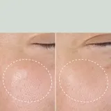 Тоник для лица Origins Checks and Balances Daily Exfoliating Toner с салициловой кислотой, 150 мл — фото 2