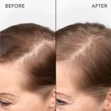 Сыворотка для кожи головы KERASILK Specialists Redensifying Scalp Serum для плотности волос, несмываемая, 100 мл — фото 2