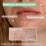 Сыворотка для лица Mixa Sensitive Skin Expert Salicylic Acid + Niacinamide, для жирной и проблемной кожи, 30 мл — фото 5