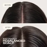 Флюид для кожи головы Goldwell Dualsenses Scalp Specialist Rebalance Hydrate Fluid несмываемый, увлажняющий, для чувствительной кожи головы, 150 мл — фото 2