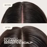 Шампунь для волос Goldwell Dualsenses Scalp Specialist Sensitive Foam Shampoo пенка, для чувствительной кожи головы, 250 мл — фото 2
