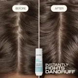 Шампунь для волос Goldwell Dualsenses Scalp Specialist Anti-Dandruff Shampoo против перхоти, увлажняющий, 250 мл — фото 2