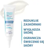 Крем для лица Ducray Keracnyl Glycolic+ с гликолевой кислотой для кожи с несовершенствами 30 мл — фото 5
