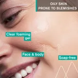 Очищающий гель для проблемной кожи Uriage Hyseac Anti-blemish Cleansing Gel, 150 мл — фото 3