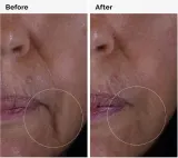 Сыворотка для лица The Ordinary GF Solution пептиды роста антивозрастной уход 30 мл — фото 5