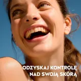 Нормализующая сыворотка для лица NIVEA Derma Skin Clear с ниацинамидом и гиалуроновой кислотой 30 мл — фото 5