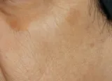 Обновляющая сыворотка для лица с ретинолом Perricone MD Triple Retinol 59 мл — фото 6
