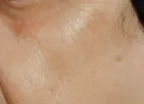 Обновляющая сыворотка для лица с ретинолом Perricone MD Triple Retinol 59 мл — фото 7