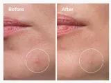 Концентрат для лица The Ordinary Sulfur 10% для проблемной кожи 5 г — фото 4