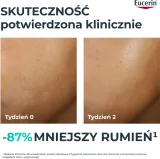 Крем для лица Eucerin DermoPure Clinical Hydra Repair 40 мл — фото 2