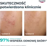 Крем для лица Eucerin DermoPure обновляющий ночной с комплексом кислот 40 мл — фото 2
