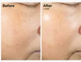 Сыворотка для лица The Ordinary Rice Lipids + Ectoin Microemulsion увлажняющая, восстанавливающая — фото 4