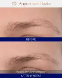 Сыворотка для роста и укрепления бровей и ресниц Augustinus Bader The Eyebrow & Lash Enhancing Serum, 8 мл — фото 5